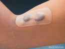 North Coast TopiGel® Silicone Gel (NC15460)