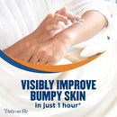 Gold Bond Rough & Bumpy Skin Therapy Cream, 8 oz