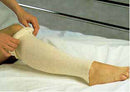 AlbaHealth® Stockinette, 10/CS