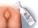 MPM Wound & Skin Cleanser, 16 oz., 1/EA