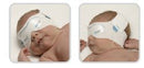 EyeMax2™ Regular Phototherapy Eye Protector, 12-3/5 – 14-9/10 Inch Occipital Frontal Circumference, 1/EA